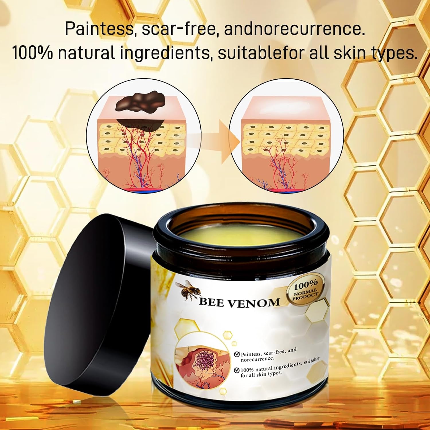 Bee Venom Repair Cream,Bee Venom Moisturizing and Nourishing Cream,Professional Bee Venom Repair Cream,Bee Venom Treatment Cream for All Parts of the Body,Suitable for All Skin Types of Men and Women