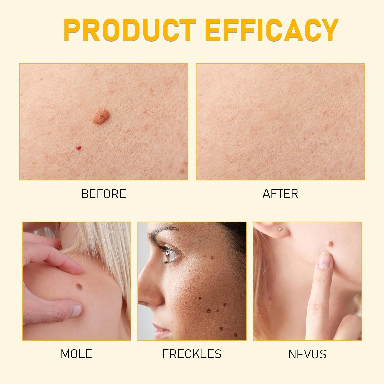 Bee Venom Skin Restoration Cream, Professional Bee Venom Skin Cream,Deeply Clean